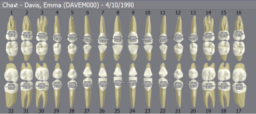 DentiMax Chart Screen