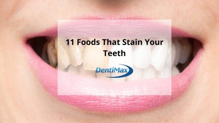 11 Foods That Stain Teeth Blog Post