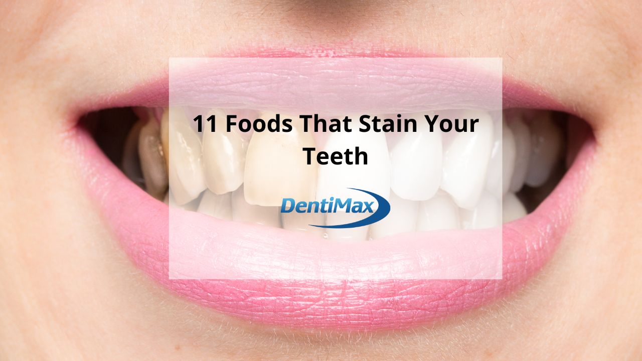 11 Foods That Stain Teeth Blog Post