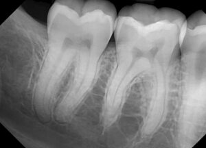 dream sensor x-ray 3