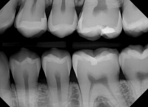 dream sensor x-ray 4