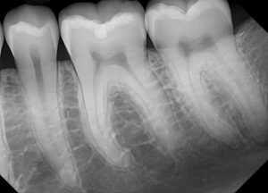 dream sensor x-ray 5