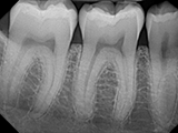 DentiMax Dream Sensor X-ray
