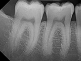Open Sensor X-ray