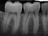 Schick Sensor X-ray
