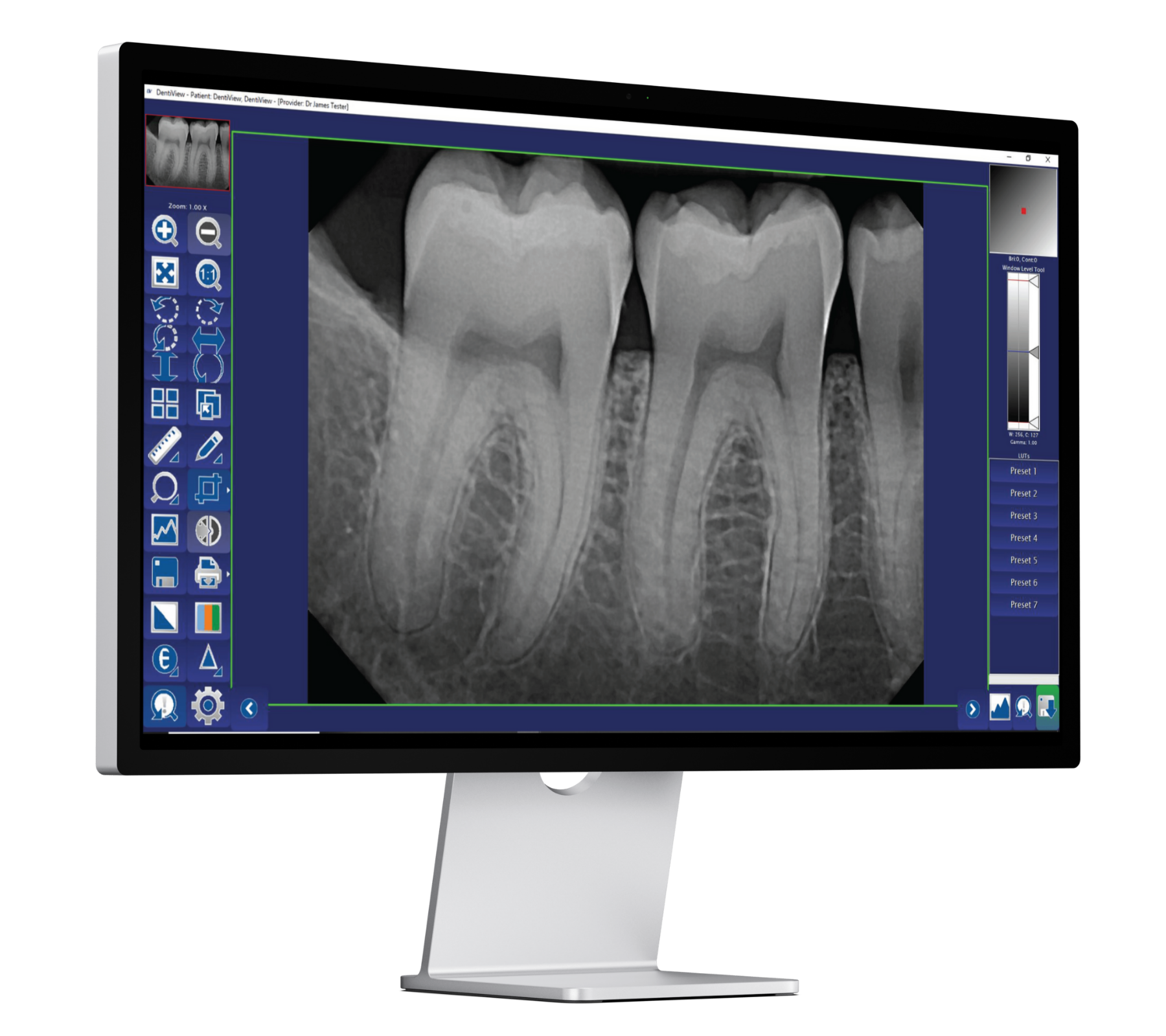 DentiView Imaging Software