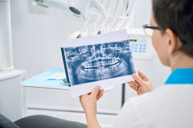 intraoral and extraoral x-rays