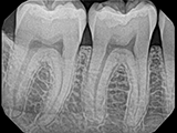 DentiMax Pro Sensor X-ray