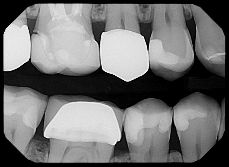 Pro Sensor<br>Dental X-Ray Sensor - Image 3